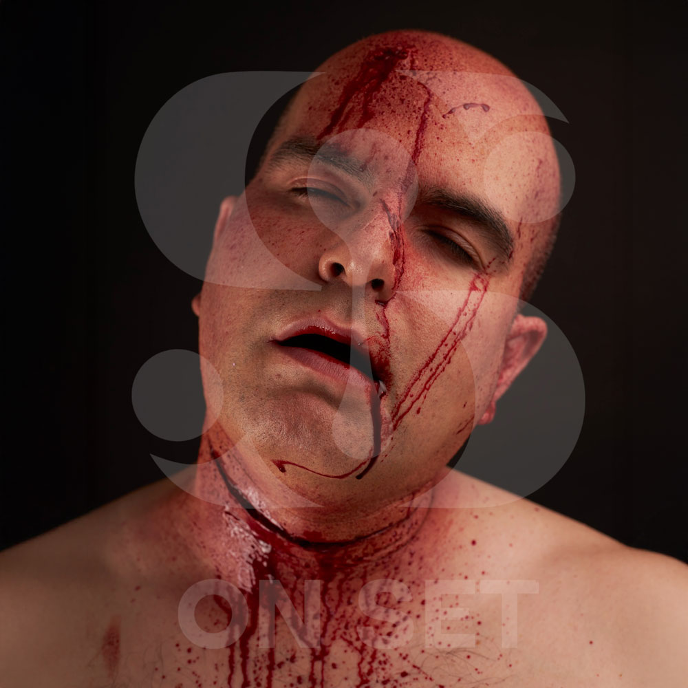 (ONSET) Prostético de Decapitado